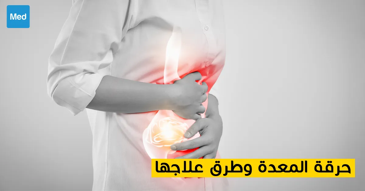 حرقة المعدة وطرق علاجها